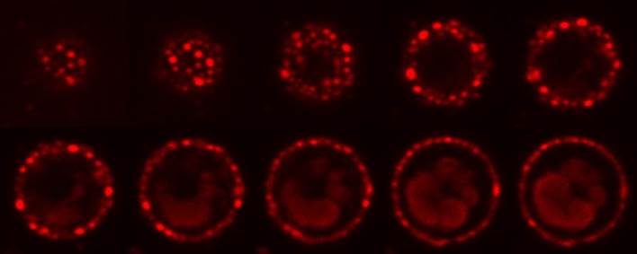 Isochyrsis under microscope